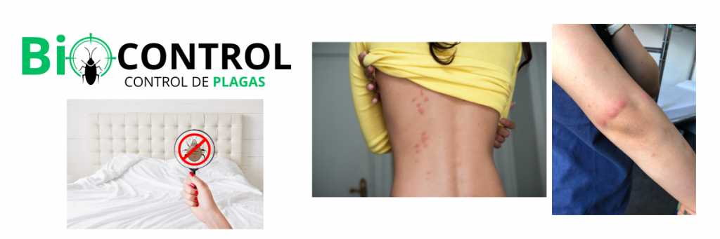 picaduras chinches